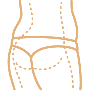 Lipoescultura con lipotransferencia a glúteos