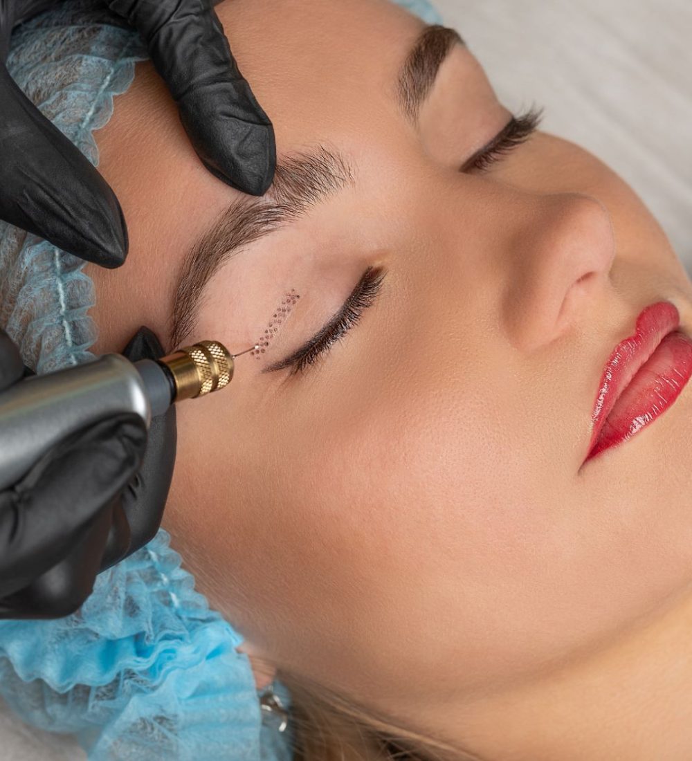 blefaroplastia-sin-cirugia blefaroplastia-sin-cirugia